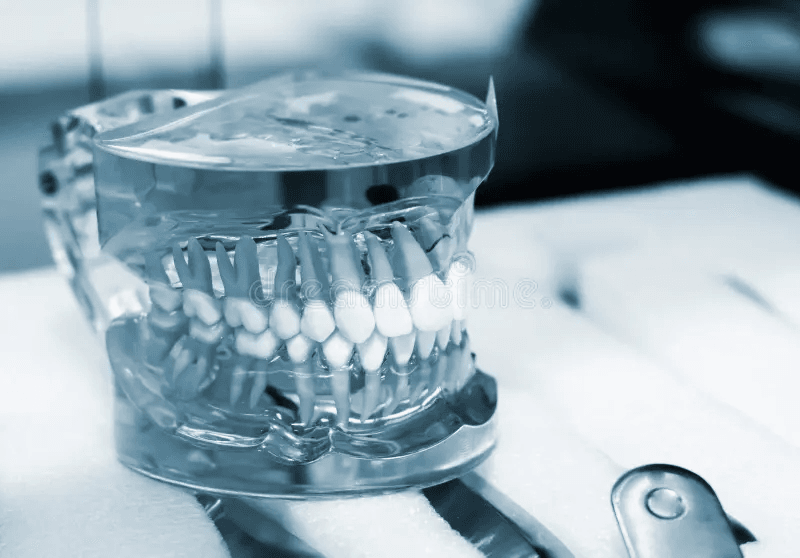 Occlusodontie chez Dentiste Casablanca