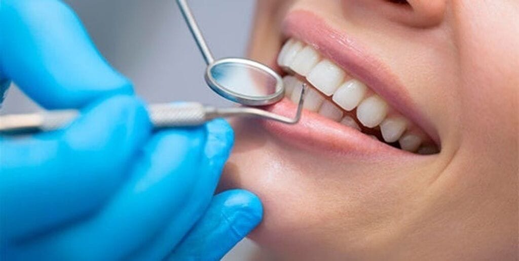 L’esthétique dentaire : Dentiste Casablanca