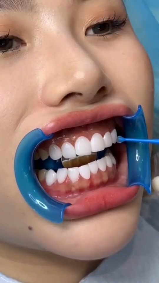 Sourire Parfait : Dentiste Casablanca Dr Benchekroun Salma