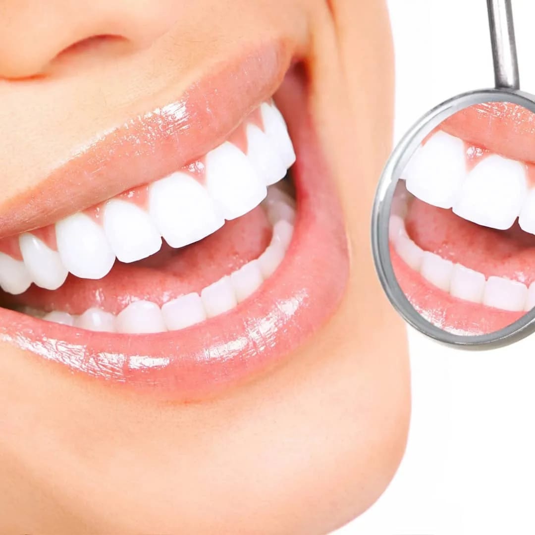 Dentiste Casablanca : Ce Que Votre Sourire Révèle sur Votre Santé