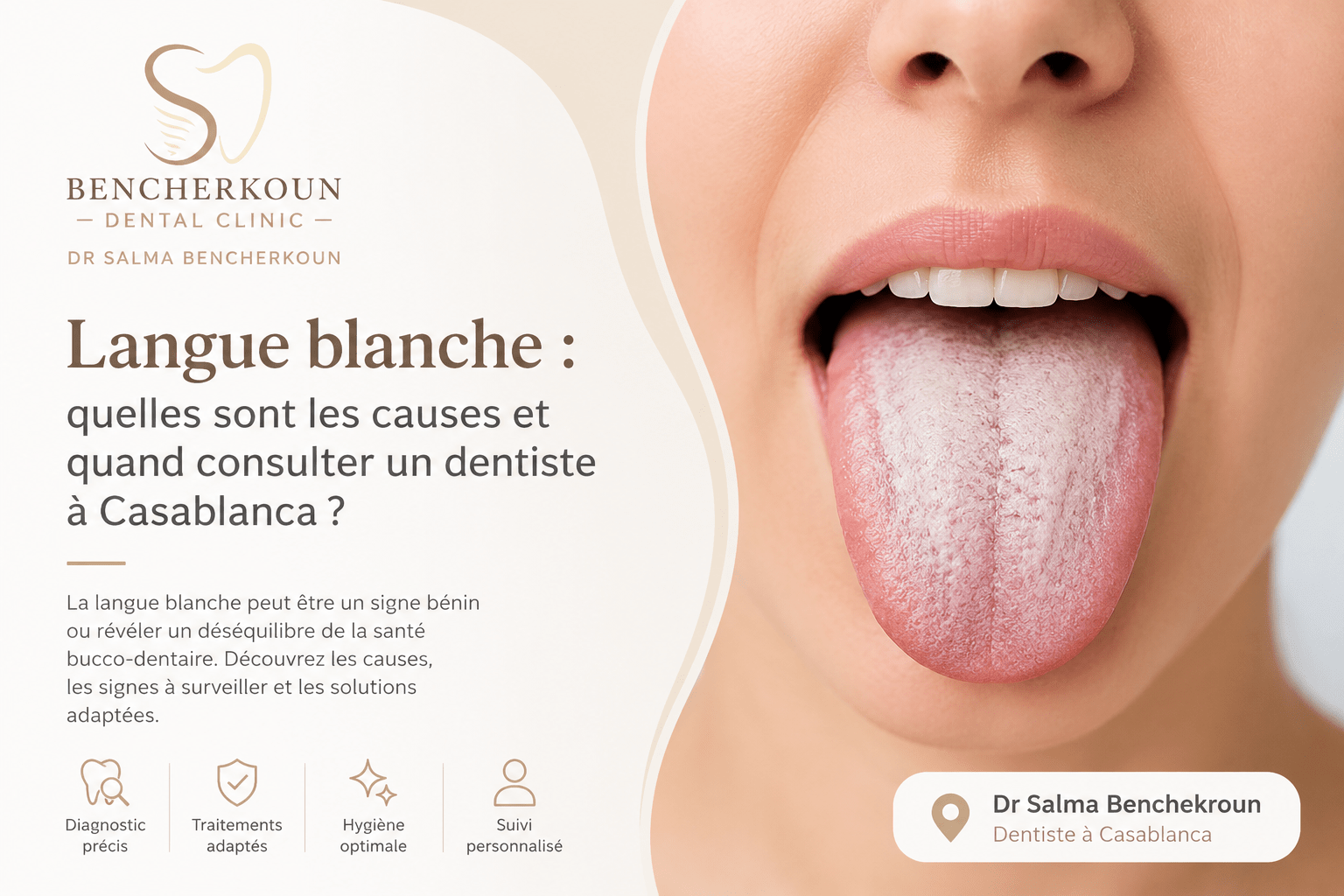 Langue blanche : quelles sont les causes et quand consulter un dentiste à Casablanca ?