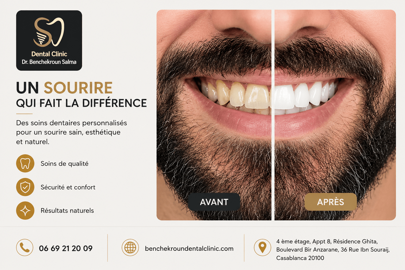 Pourquoi la dévitalisation est l’un des soins les plus importants en dentisterie moderne ?