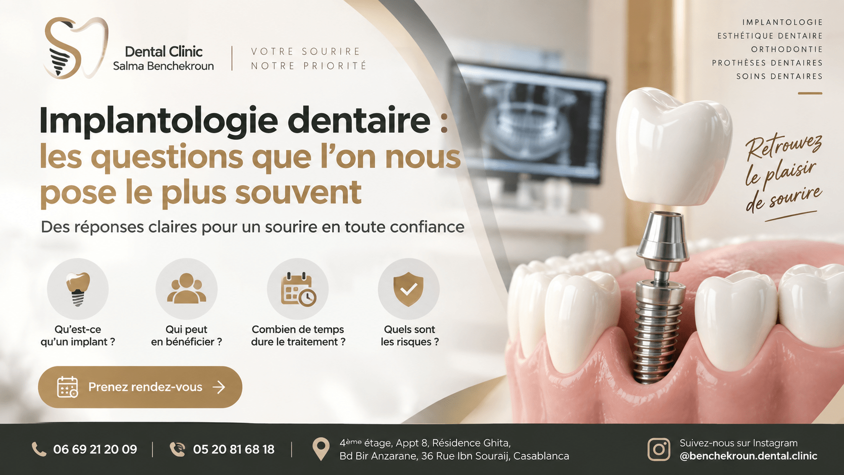 Implantologie dentaire : les questions que l’on nous pose le plus souvent
