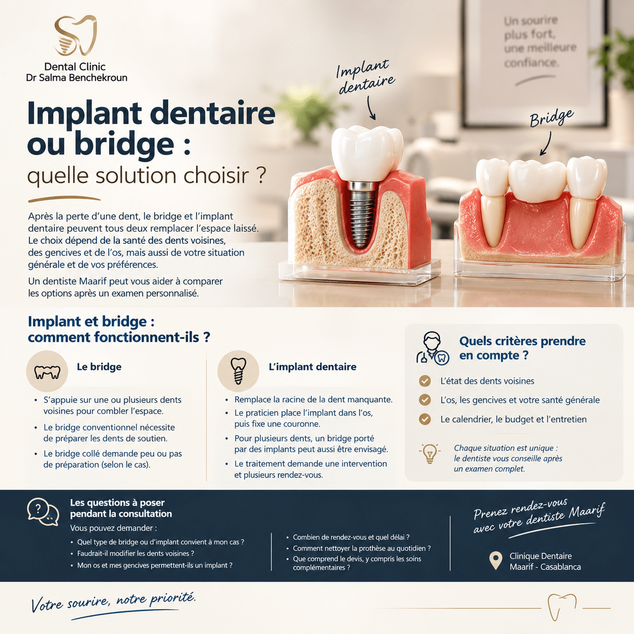 Implant dentaire ou bridge : quelle solution choisir ?
